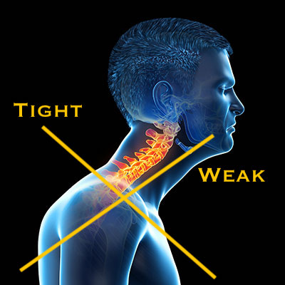 Therapeutic Massage for Upper Crossed Syndrome