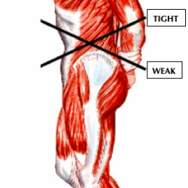 Postural Syndrome Series