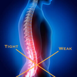 Therapeutic Massage for Lower Crossed Syndrome